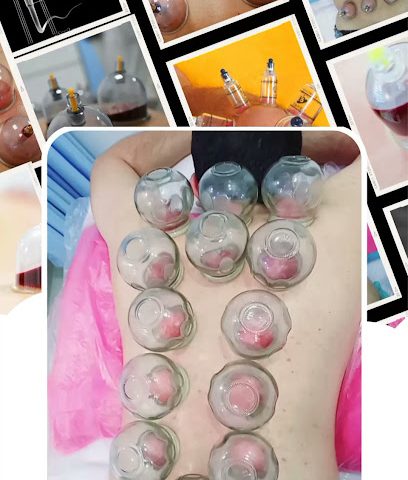 مركز الحجامة الطبى صحم / مركز الحجامة صحم - صحم - +968 9193 2821