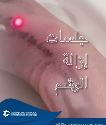 فنلندا الجلدية والتجميل وطب الأسنان - مسقط -